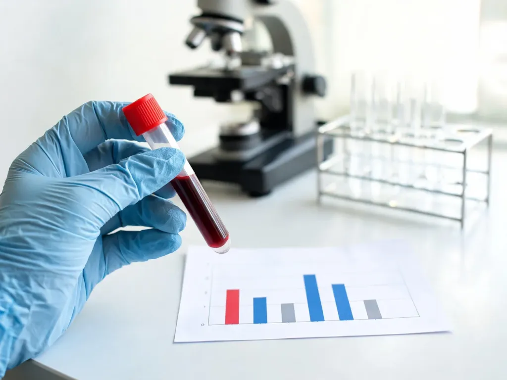 Próbka krwi w probówce i wydruk morfologii, symbolizujące diagnostykę podwyższonych monocytów we krwi